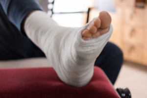 Understanding Lisfranc Fractures