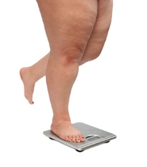 The Effects Obesity Has On the Feet