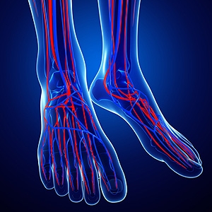 Ankle-Brachial Index and PAD