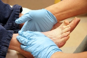 Foot Care and Diabetes