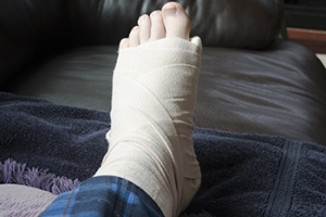 Managing a Broken Foot