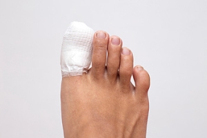 What to Expect When You Break Your Toe