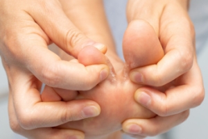 Treatment and Prevention of Athlete’s Foot